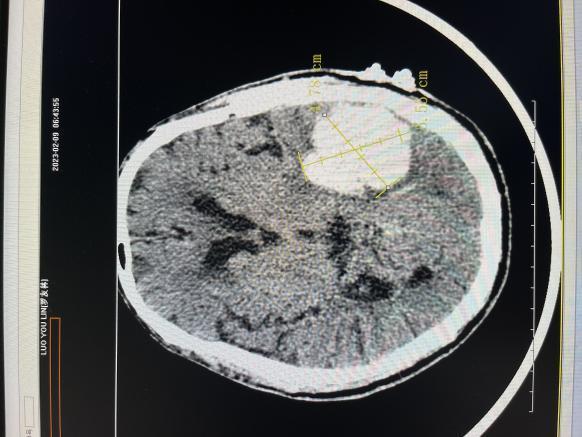 1f0f6e9edd7d60c8ddeb000667db58f