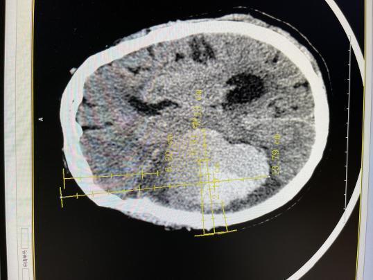 ad78cc657880f8177b37cfd2b7d4051