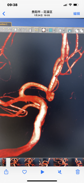 ada1d99a2f679771cddc2ff662f54f6