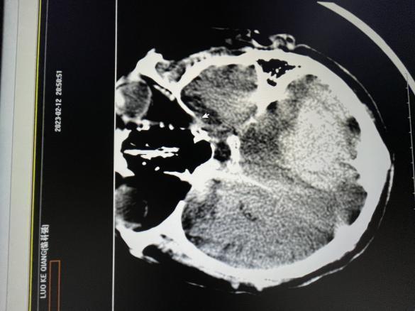 34f3ba00b547167f3078a9ae6a551e0