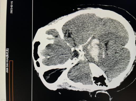 6d53f3d6dc47e8ead99e1cb0ba860b2