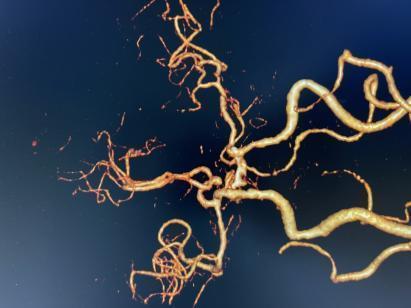 ea4991b04b727c2836e2ab288ced519