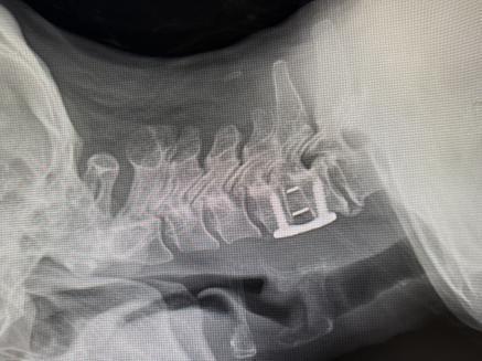 7a180cc09f8e0985dfdff6a8cf998c4