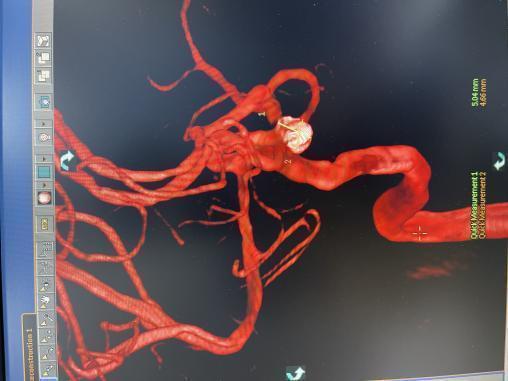 46d2a588e0517a9e804ff5e5ca5f238