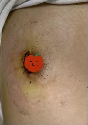 ef072e01d32ad4d19d972daf36c320bf